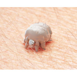 A-Scabies Permethrin Lotion 30ml A-Scabies Permethrin Lotion 30ml