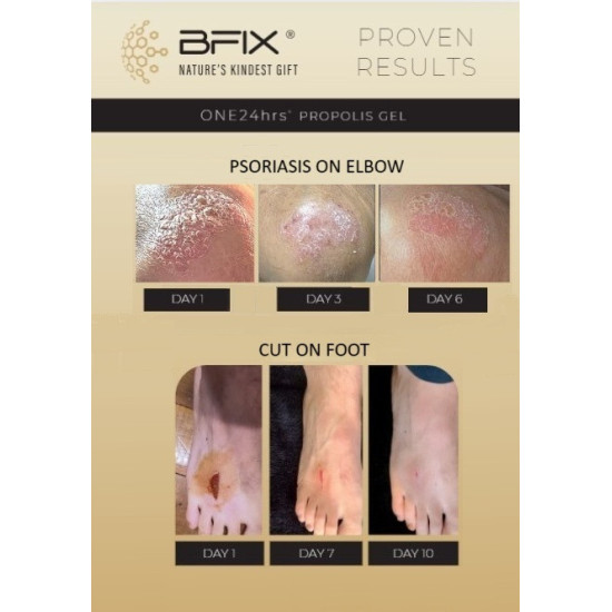 BFIX ONE24hrs Propolis Gel 30ml