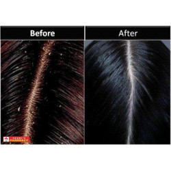 Selsun Gold Anti Dandruff Treatment Shampoo 200ml Selsun Gold Anti Dandruff Treatment Shampoo 200ml